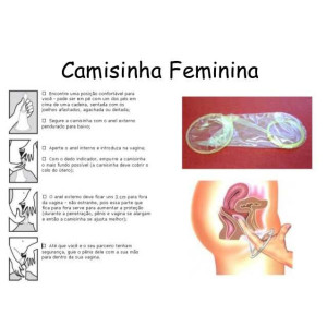 PRESERVATIVO FEMININO DELLA foto 3